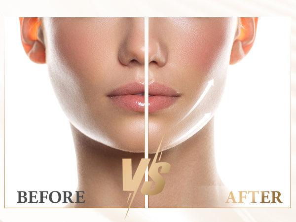 جهاز تدليك كهربائي لتشكيل الوجه على شكل حرف V من انلان